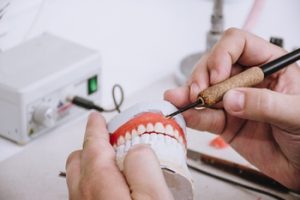 Dentures That You Can Wear All the Time fabrication