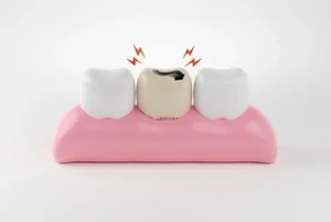 Can Tooth Decay Spread neighbor