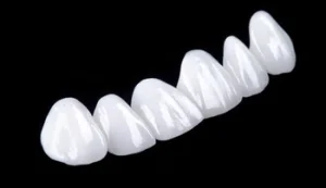 teeth veneers shells