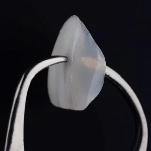 veneer procedure shell